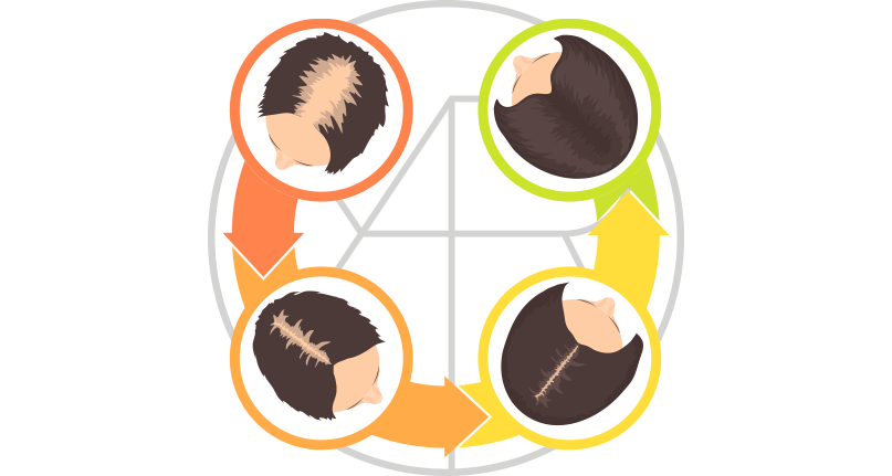 imagem-interna-Restauração-de-perda-de-cabelo-em-ferimentos-e-queimaduras-Mario-Rodrigues